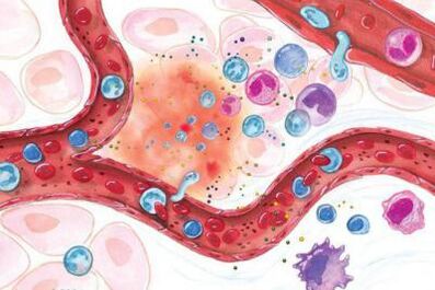 Boswellia ietekme uz iekaisušajām ķermeņa zonām